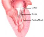 Mitral Valve Cross-Section  Copyright © Cleveland Clinic