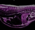 MRI Scan of Cavalier King Charles Spaniel by RVC
